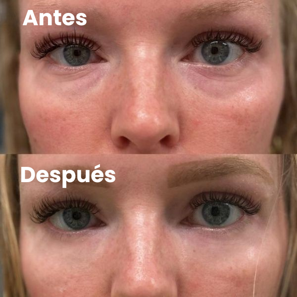 Parches Para Ojos InstantFirm