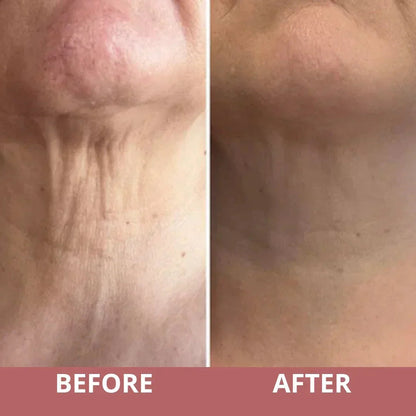 TIGHTEN & LIFT NECK CREAM by Cradella