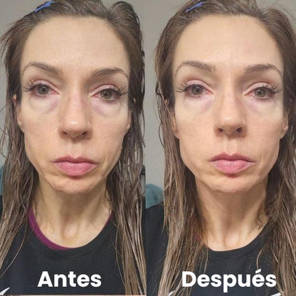 Parches Para Ojos InstantFirm