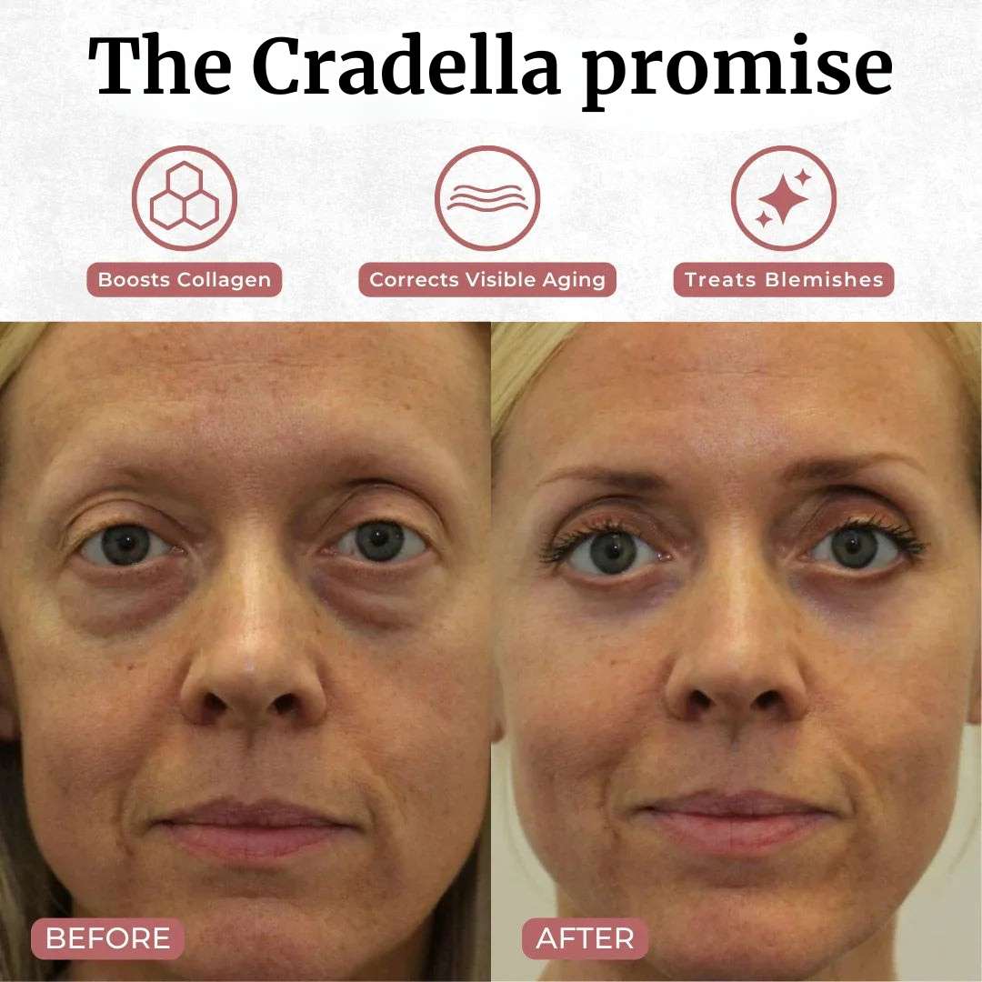 Cradella Revive - Light Eye Massage Cream